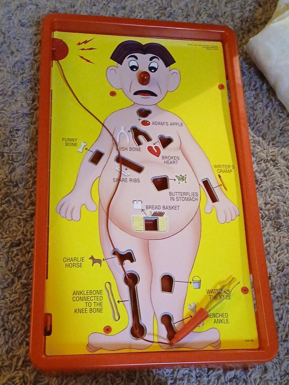 Operation Skill Game - Yellow and Red Box - Picture 6 of 8